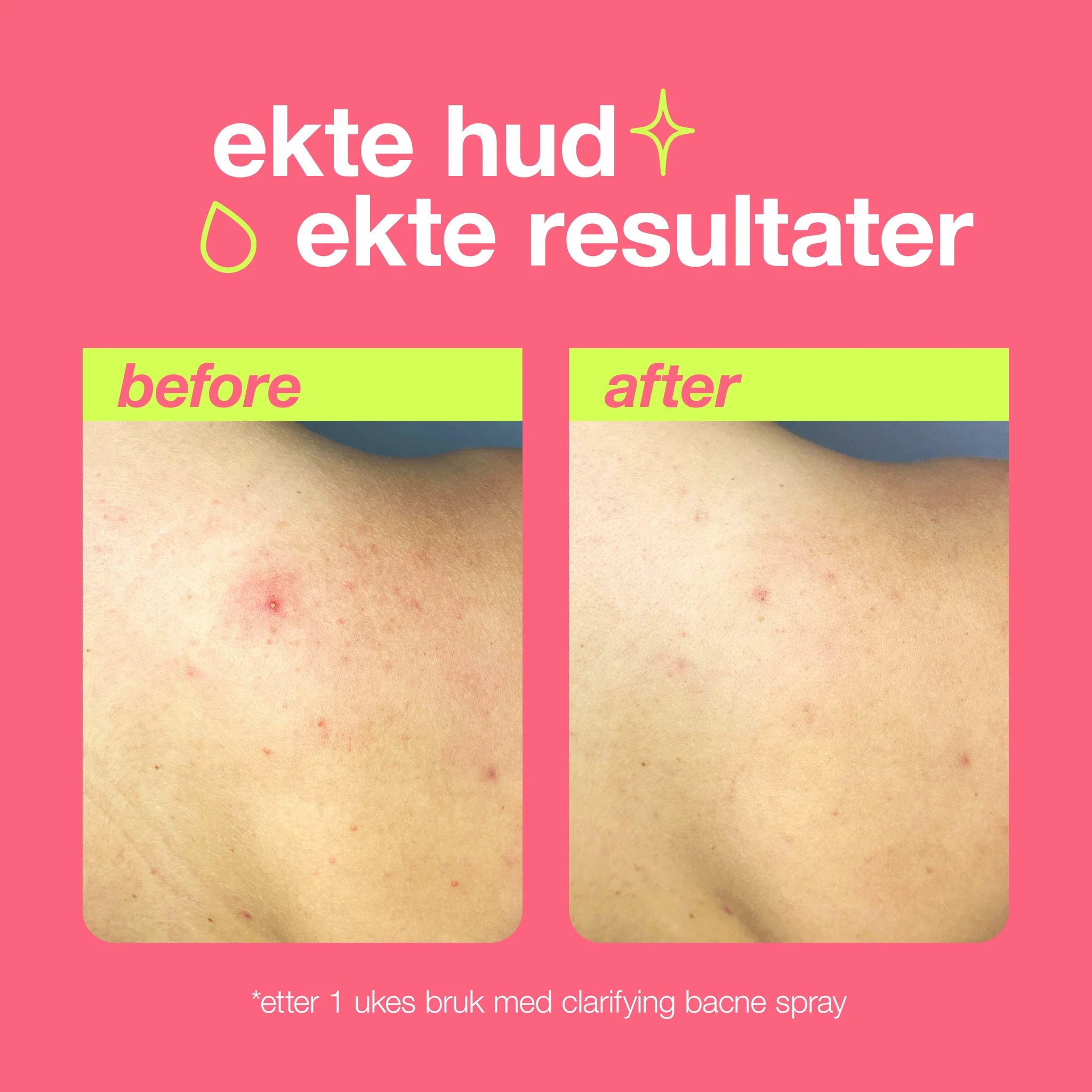 Dermalogica Clearing Body Spray