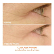 Spectralite Eye Care Pro