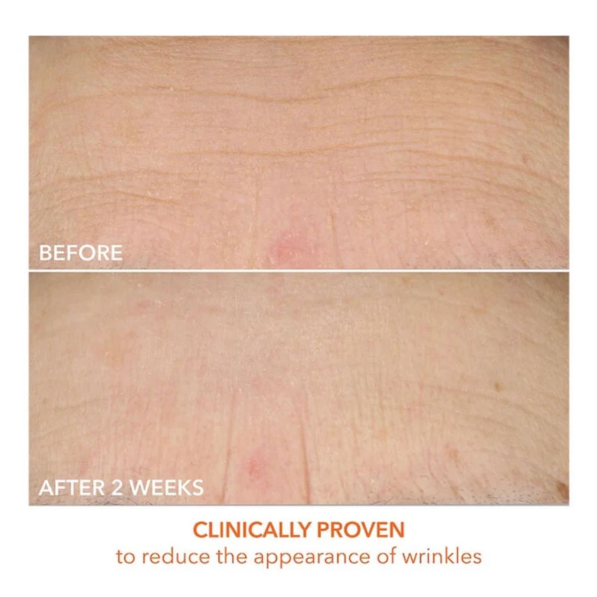 Dewy Deep Cream 60ml