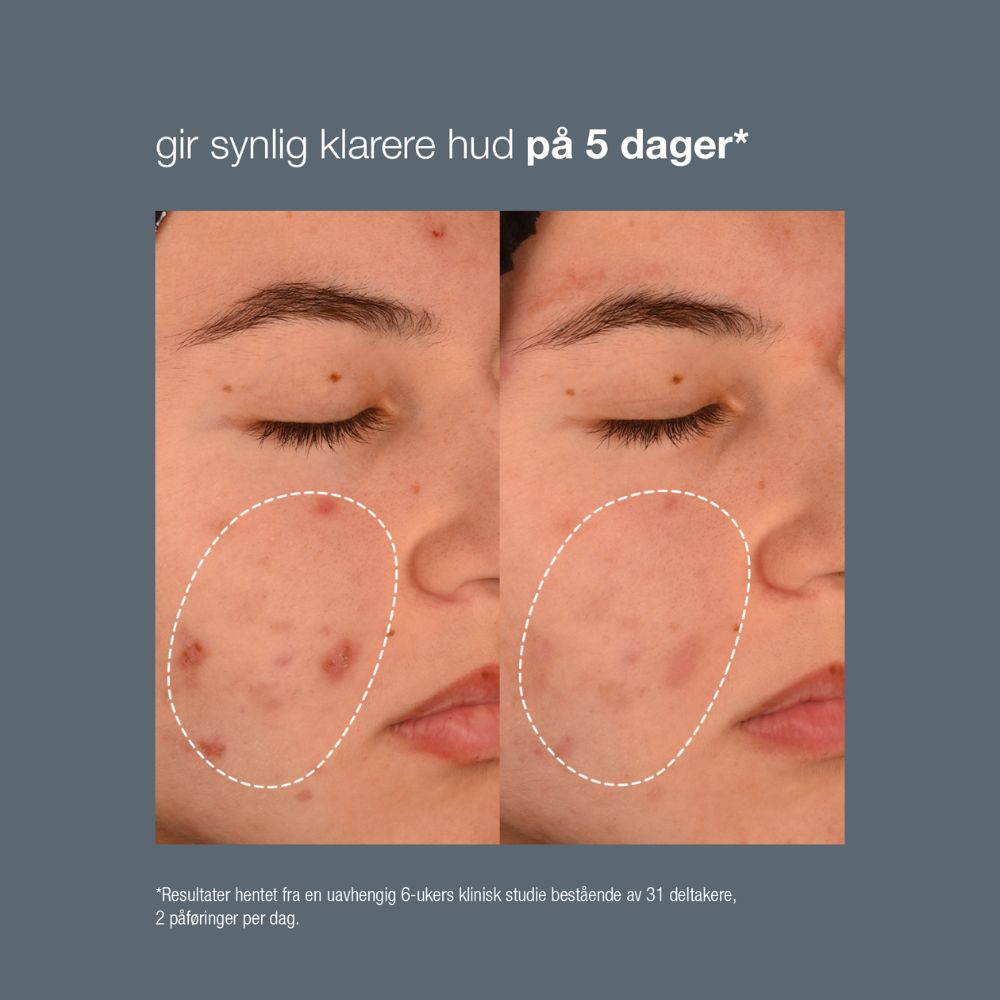 Breakout Biotic Moisturizer