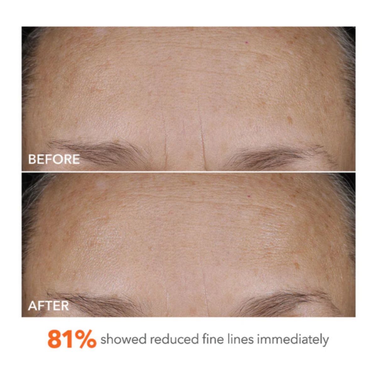 DermInfusions Blur + Repair Cream 50ml