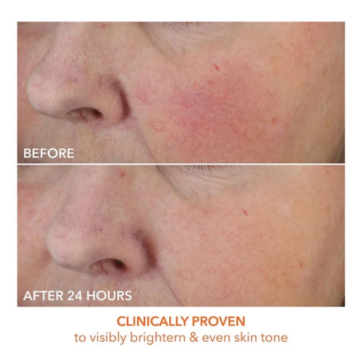 Dewy Deep Cream 60ml