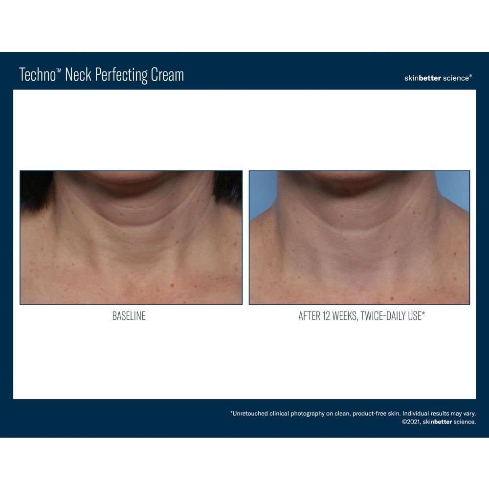 Techno Neck Perfecting Cream 50ml