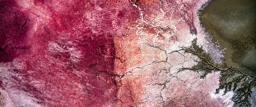 Rosacea: Alt du trenger å vite
