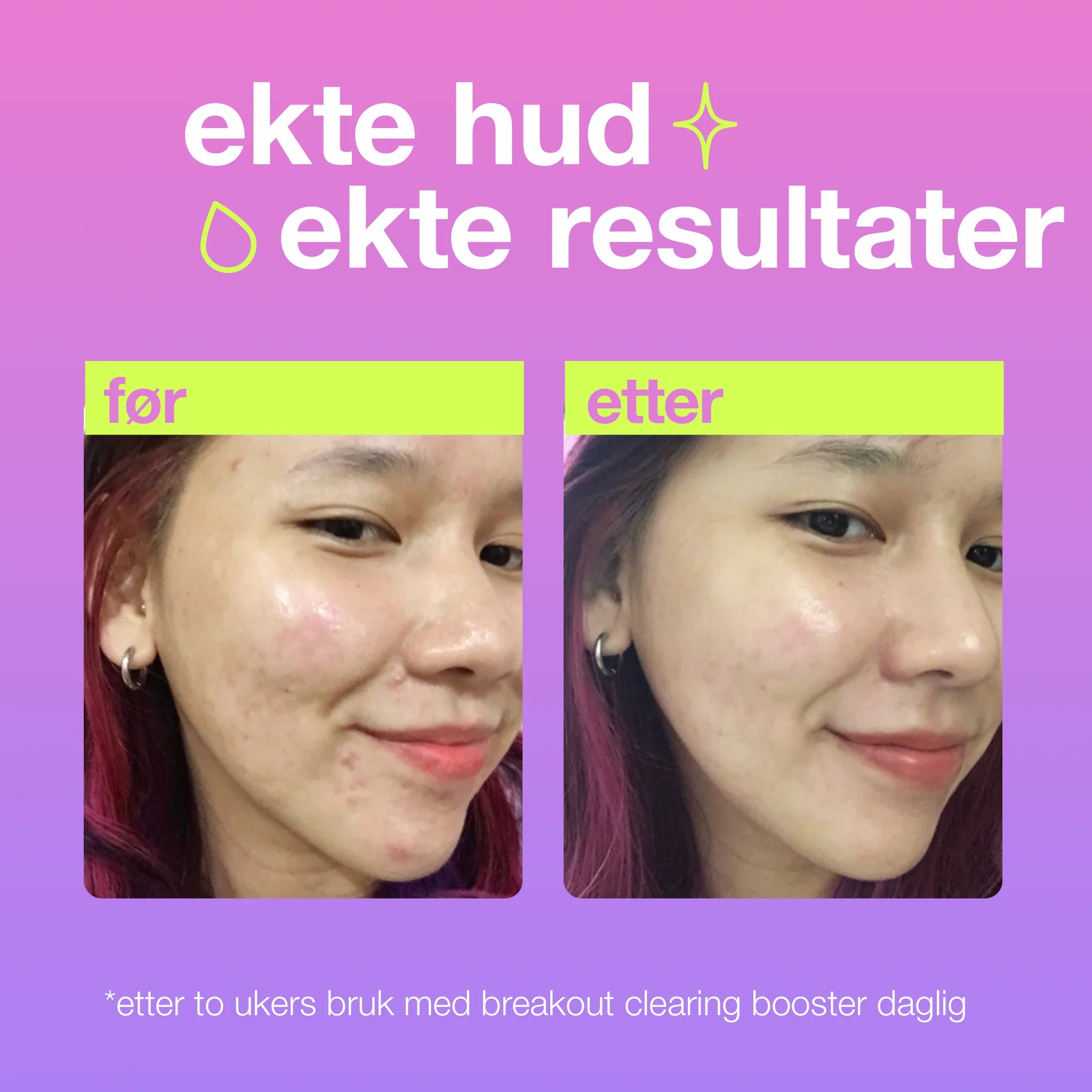 Dermalogica Breakout Clearing Booster 