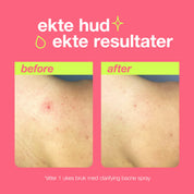 Dermalogica Clearing Body Spray