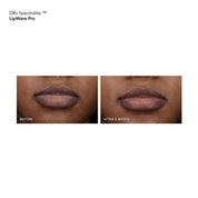 DRx SpectraLite LipWare Pro