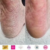 Instant Foot Peeling Spray