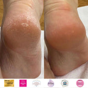 Instant Foot Peeling Kit