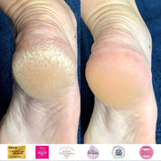Instant Foot Peeling Spray