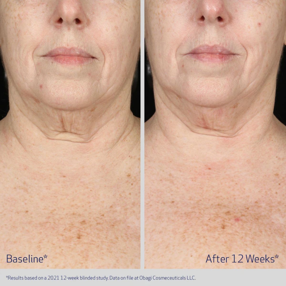 Neck and Décolleté Concentrate 60ml