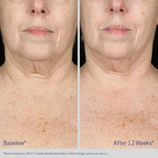 Neck and Décolleté Concentrate 60ml