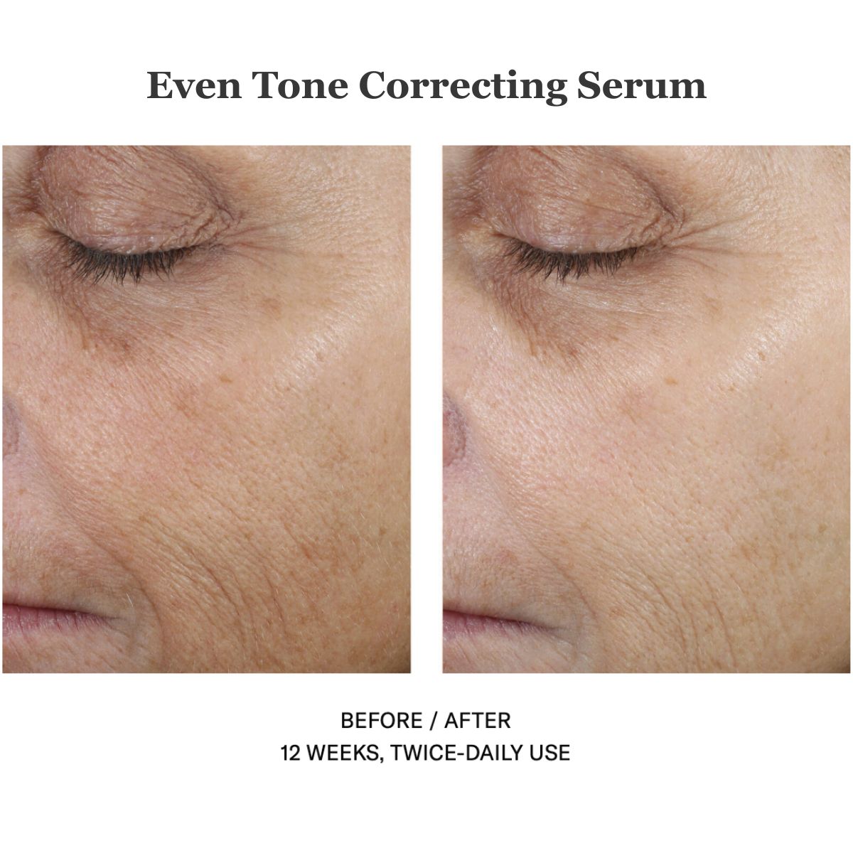 Even Tone Correcting Serum 50ml