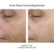 Even Tone Correcting Serum 50ml