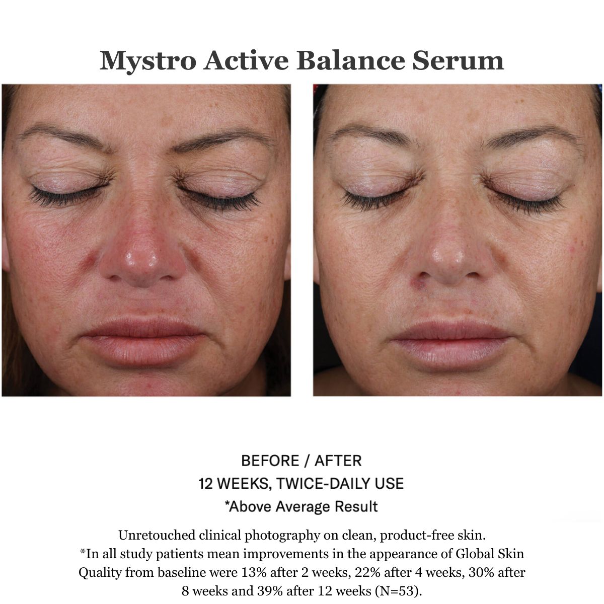 Mystro Active Balance Serum 30ml