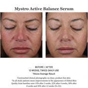 Mystro Active Balance Serum 30ml