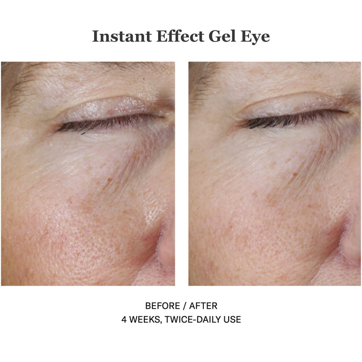 Instant Effect Gel Eye 15ml