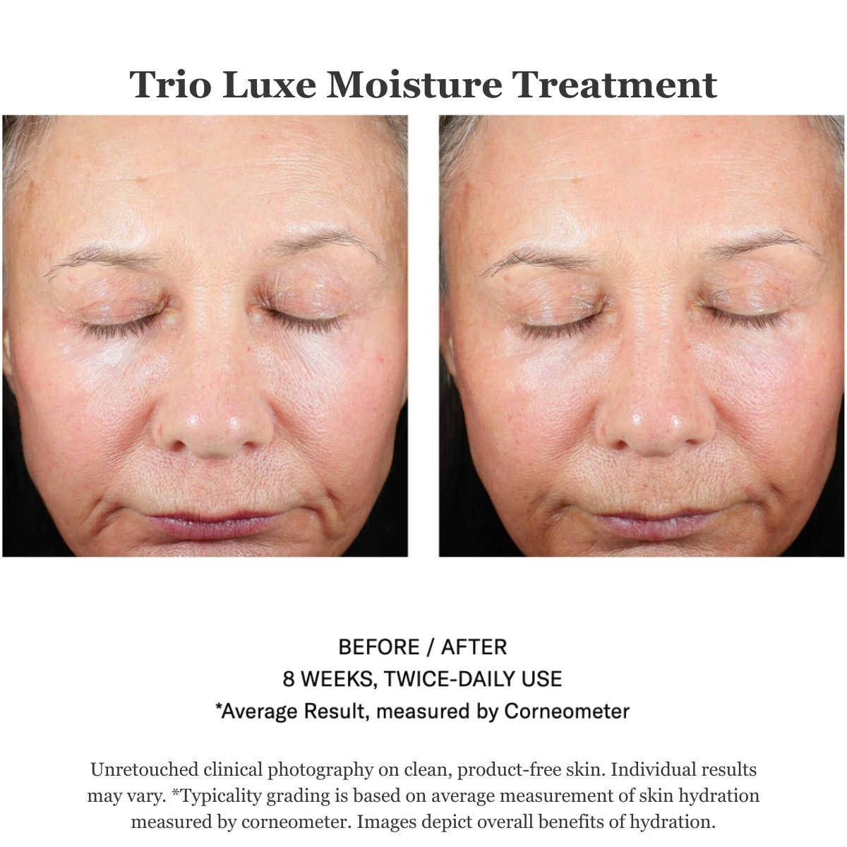Trio Luxe Moisture Treatment 50ml
