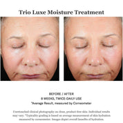 Trio Luxe Moisture Treatment 50ml