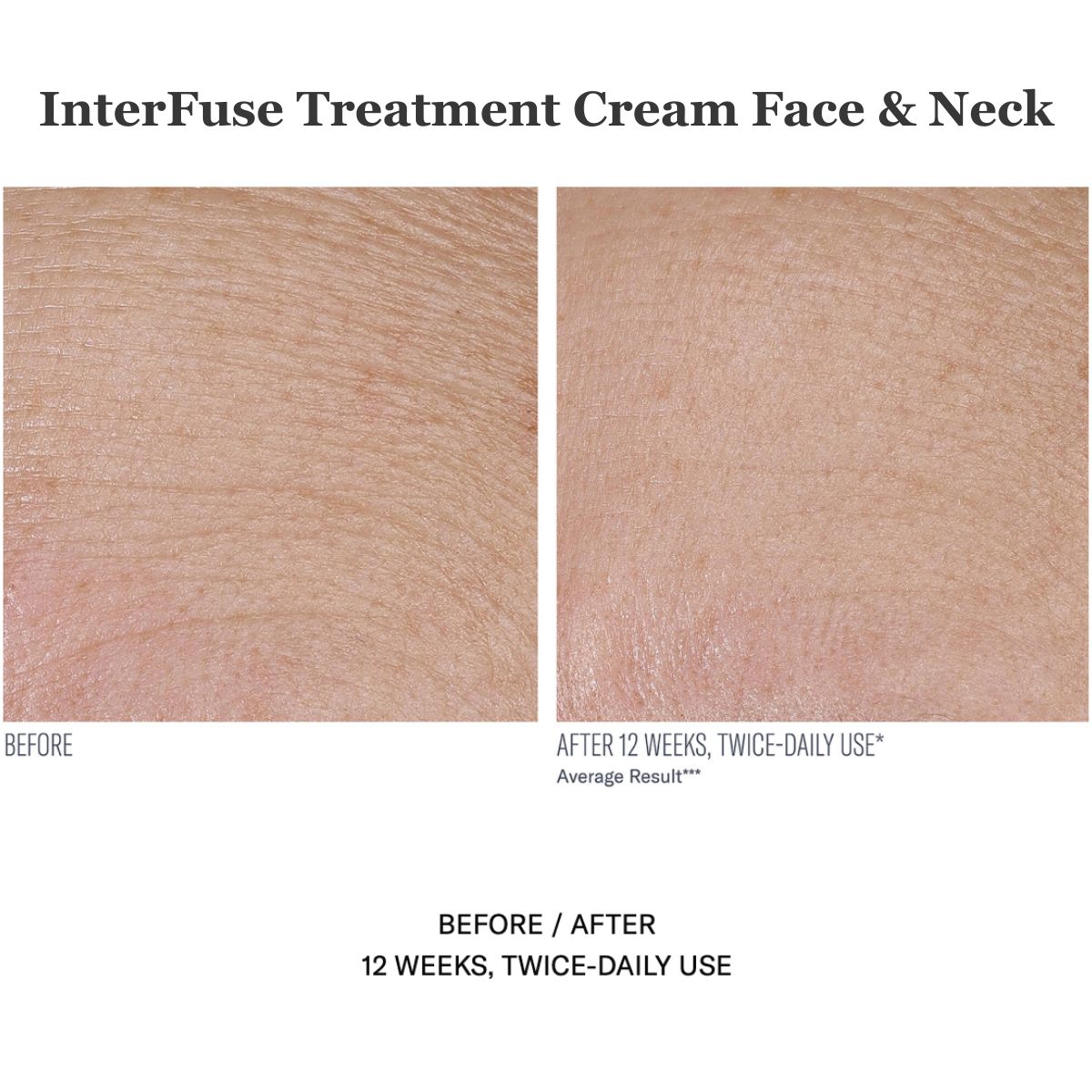 InterFuse Treatment Cream Face & Neck 30ml