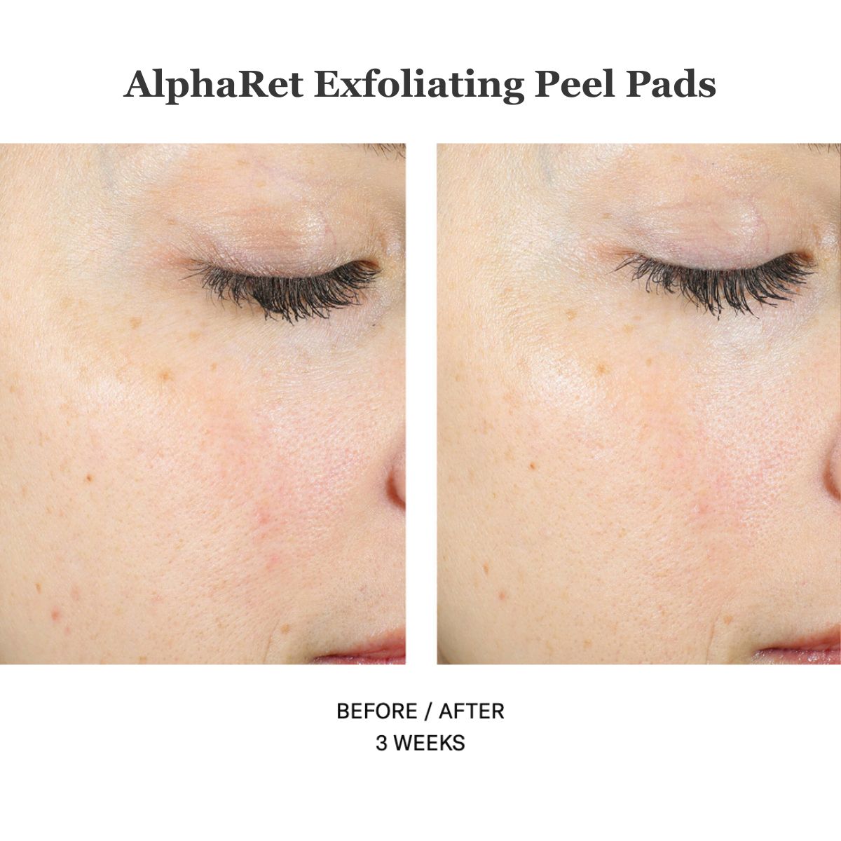Alpharet Exfoliating Peel Pads 30stk