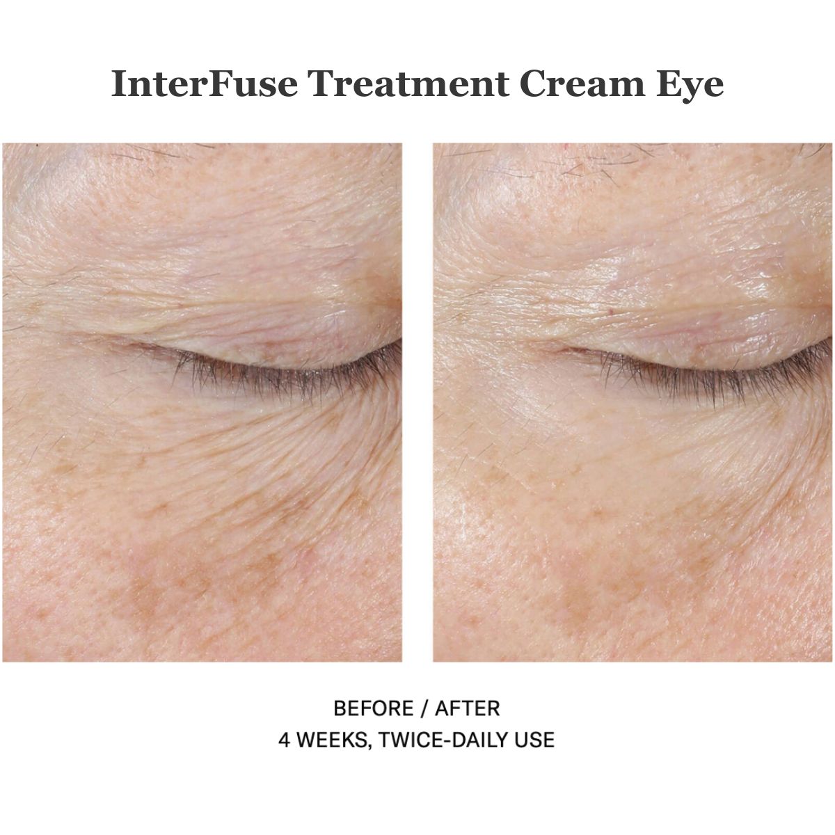 InterFuse Treatment Cream Eye 15ml