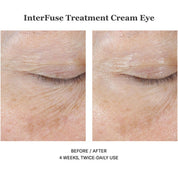 InterFuse Treatment Cream Eye 15ml