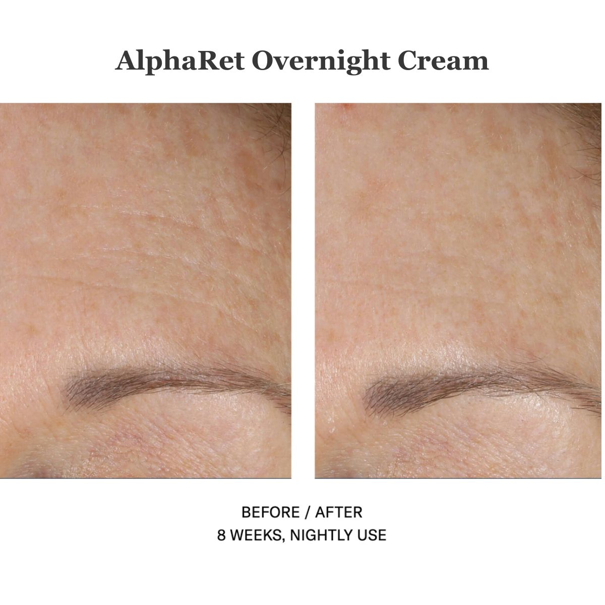Alpharet Overnight Cream 30ml