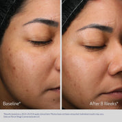 Retinol +PHA Refining Night Cream 50ml