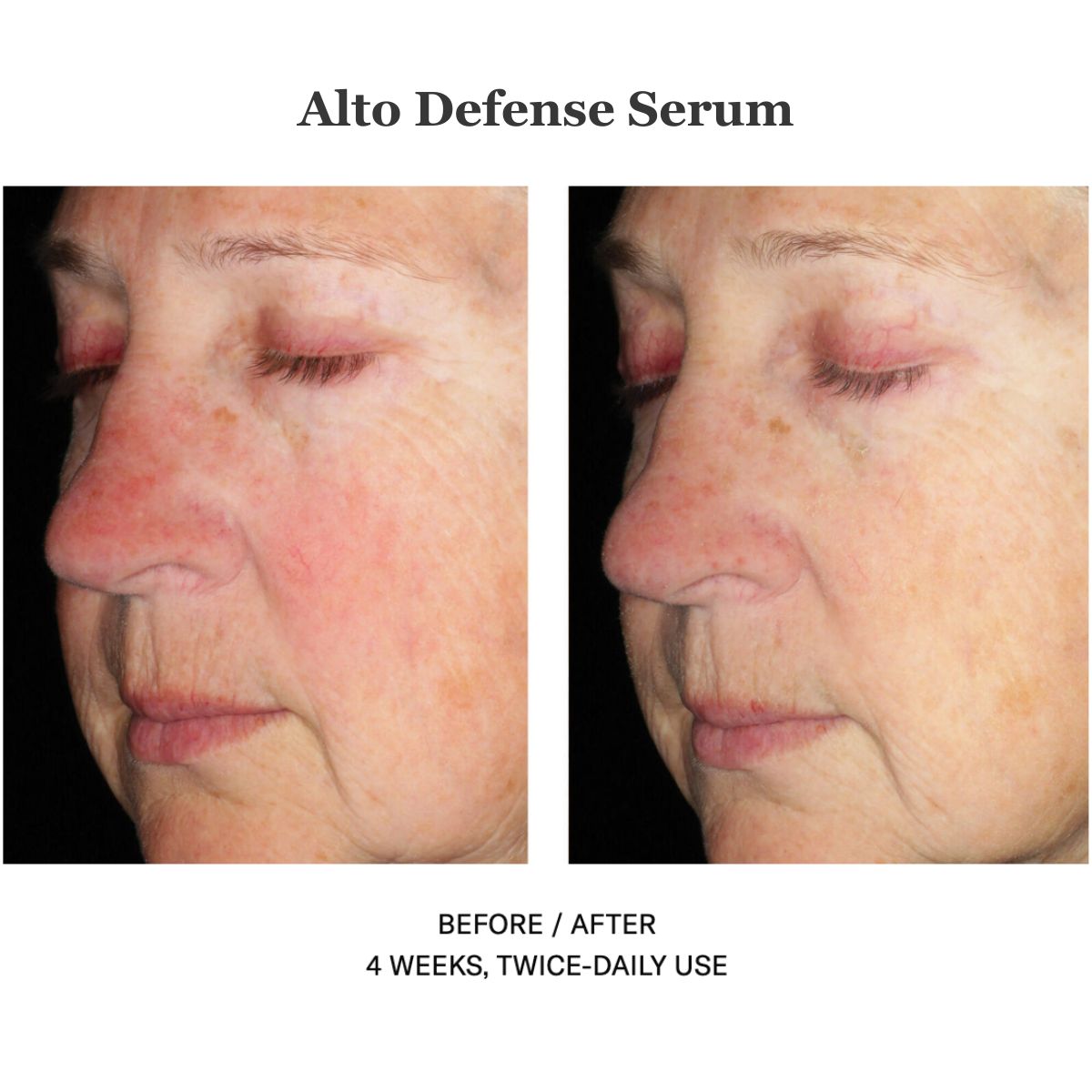 Alto Defense Serum 30ml