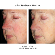 Alto Defense Serum 30ml
