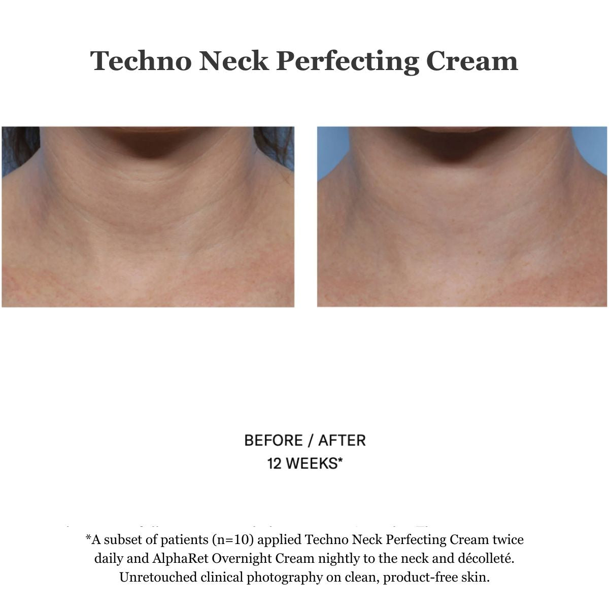 Techno Neck Perfecting Cream 50ml