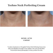Techno Neck Perfecting Cream 50ml
