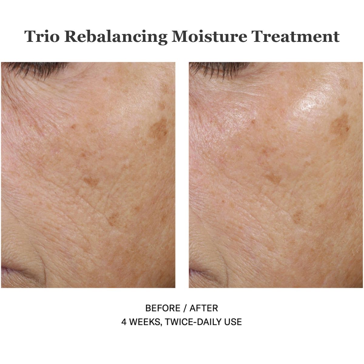 Trio Rebalancing Moisture Treatment 50ml