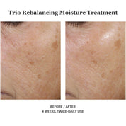 Trio Rebalancing Moisture Treatment 50ml
