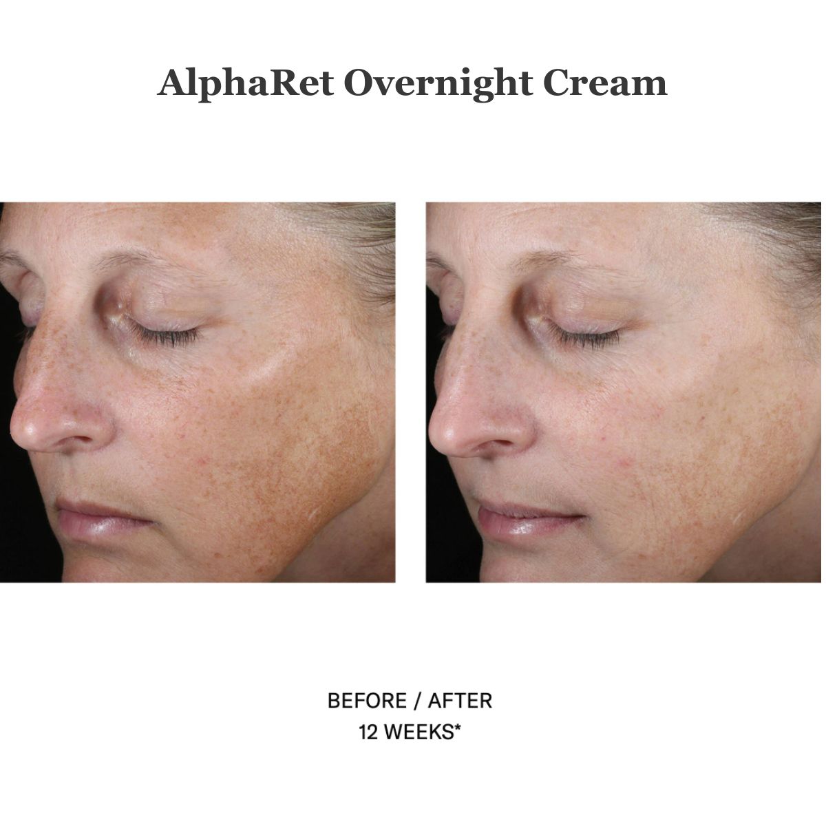 Alpharet Overnight Cream 30ml