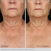Neck and Décolleté Concentrate 60ml