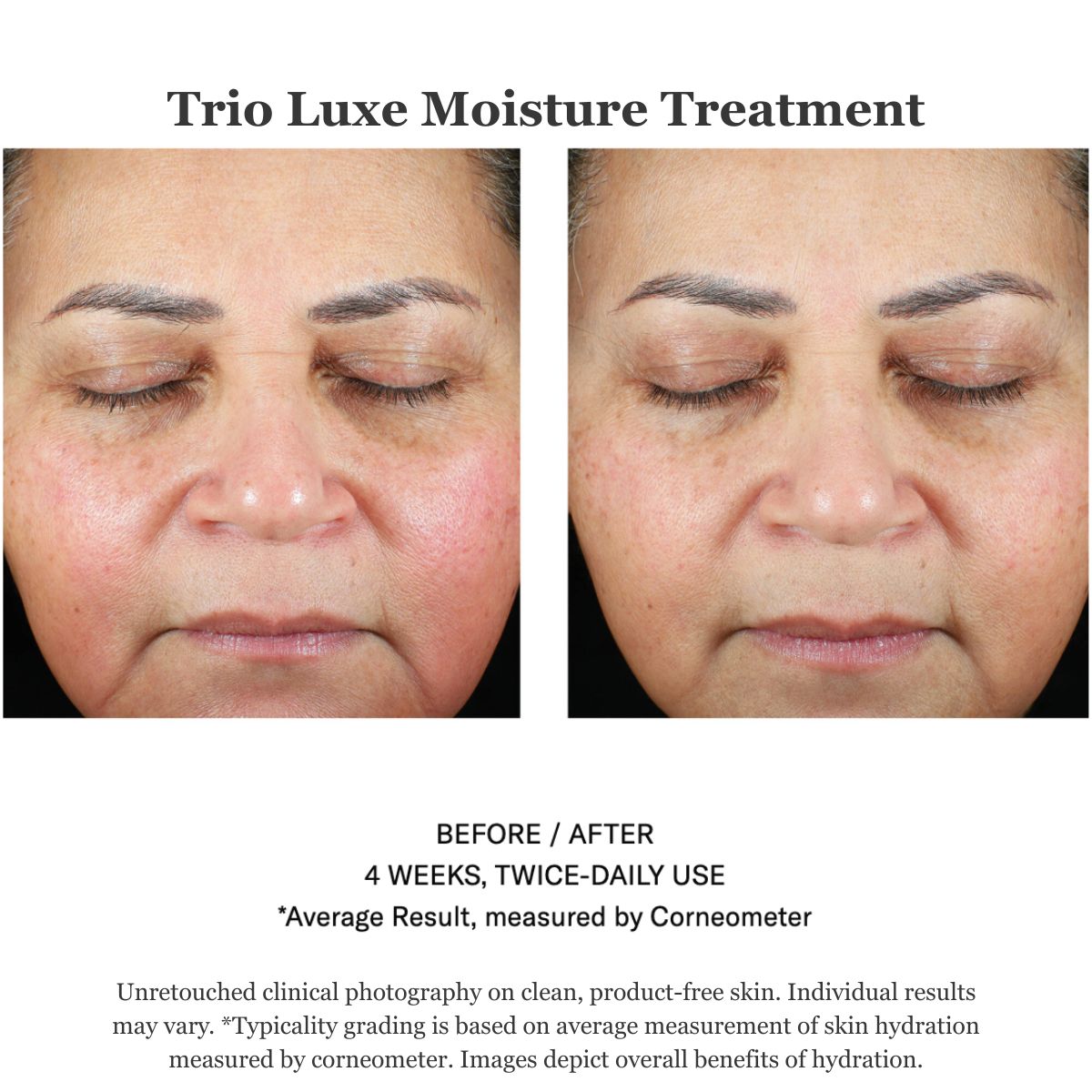 Trio Luxe Moisture Treatment 50ml