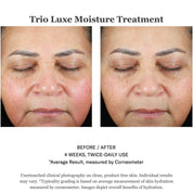 Trio Luxe Moisture Treatment 50ml