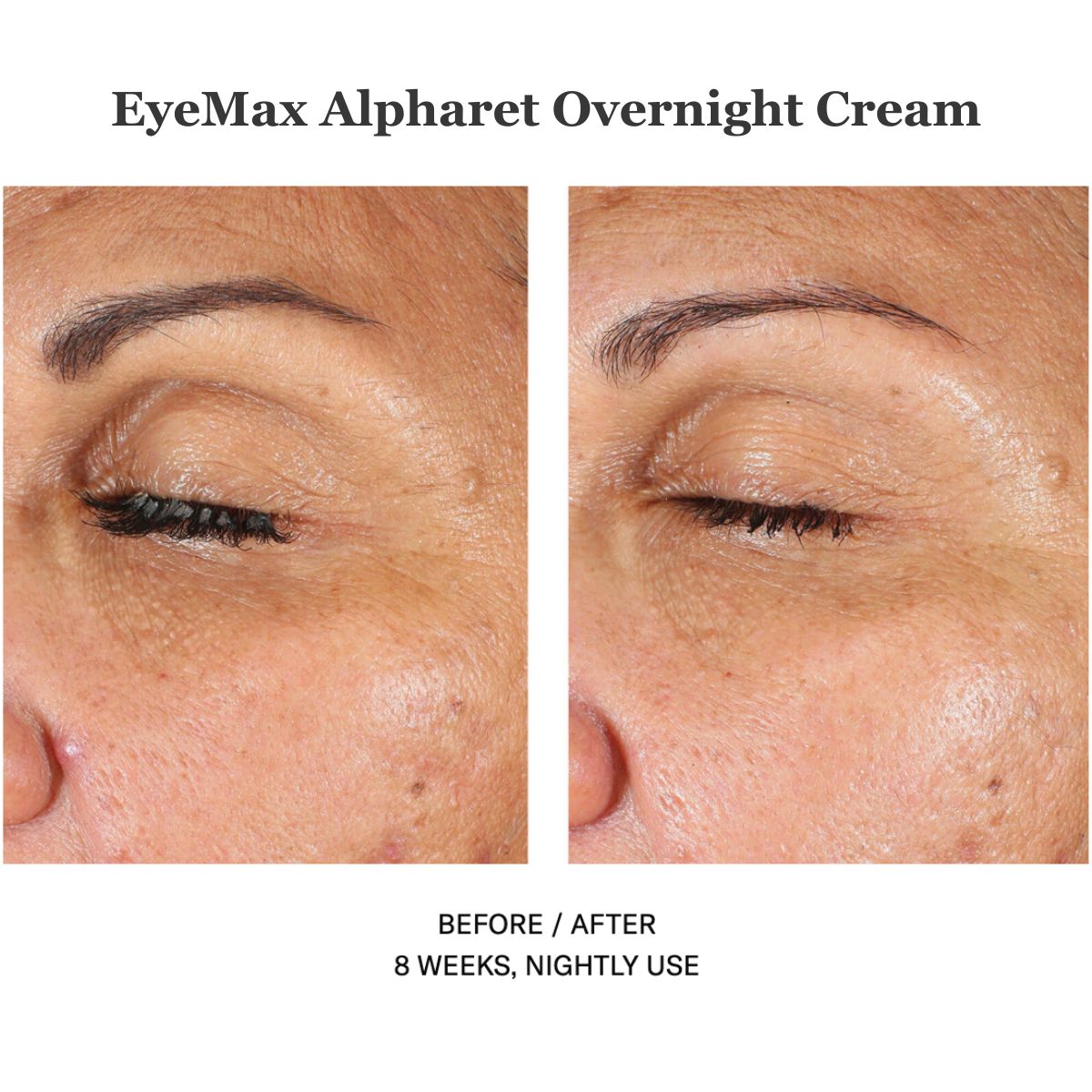 EyeMax Alpharet Overnight Cream 15ml