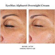 EyeMax Alpharet Overnight Cream 15ml