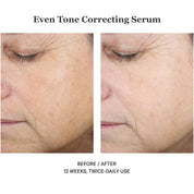 Even Tone Correcting Serum 50ml