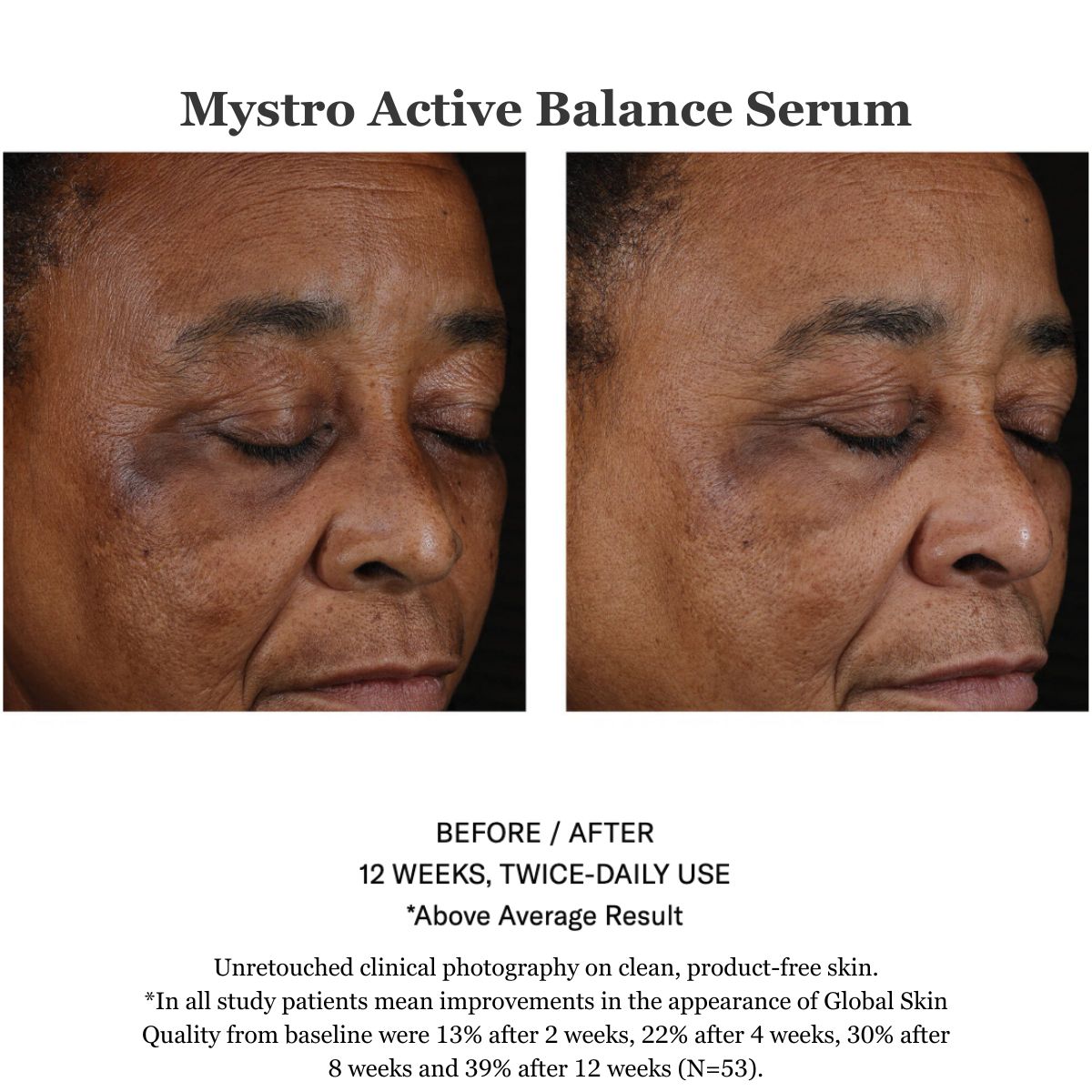 Mystro Active Balance Serum 30ml