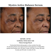 Mystro Active Balance Serum 30ml