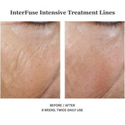 Interfuse Intensive Treatment Lines 15ml