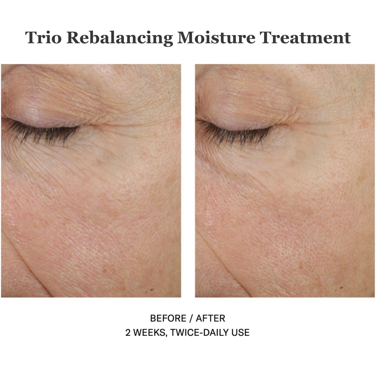 Trio Rebalancing Moisture Treatment 50ml
