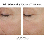 Trio Rebalancing Moisture Treatment 50ml