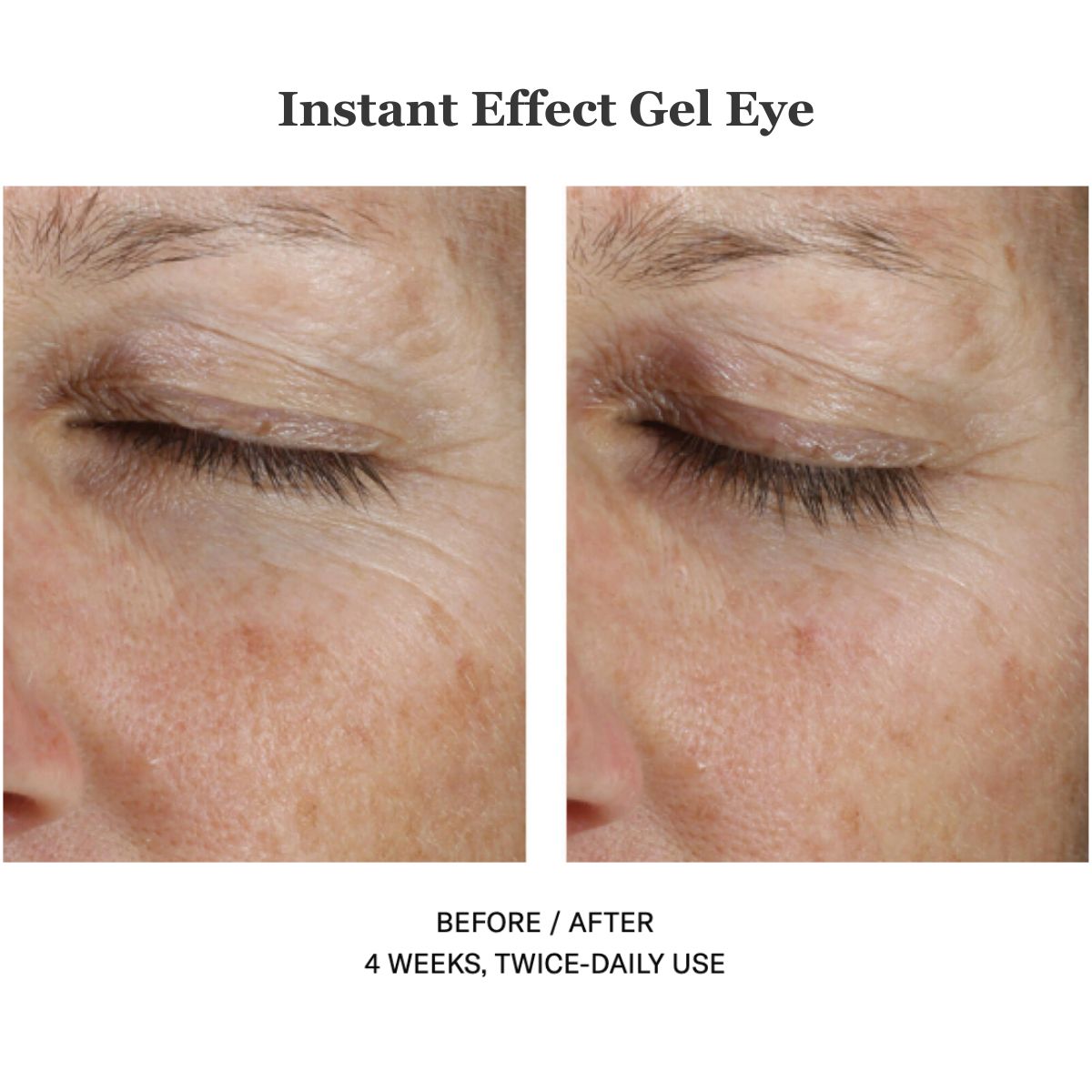 Instant Effect Gel Eye 15ml