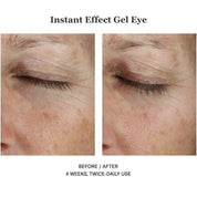 Instant Effect Gel Eye 15ml