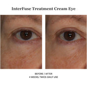 InterFuse Treatment Cream Eye 15ml
